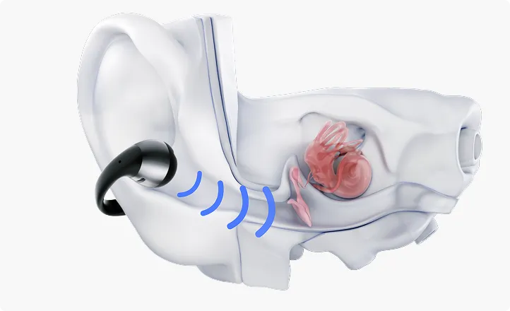 Écouteurs open-ear favorisant le bien-être auditif, ventilation et hygiène optimales.