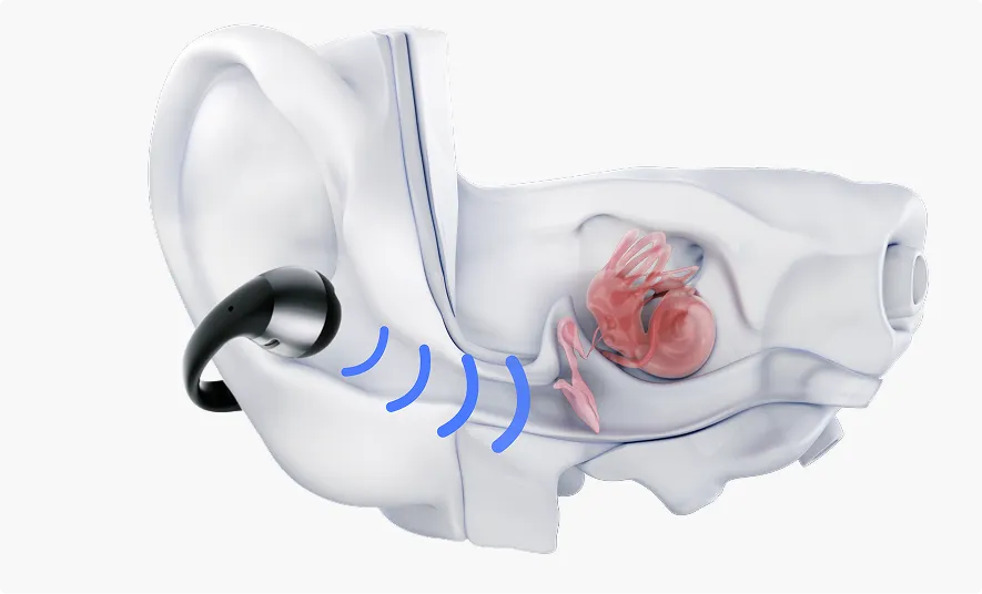 Écouteurs open-ear favorisant le bien-être auditif, ventilation et hygiène optimales.